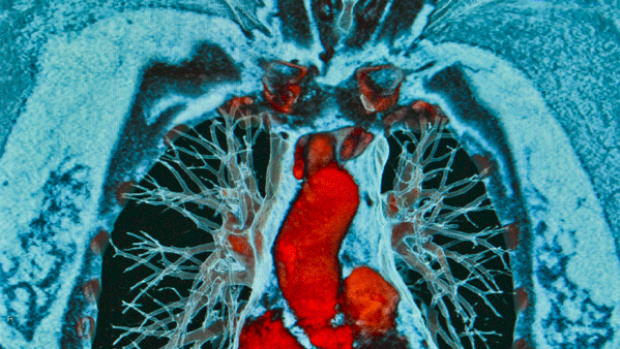 red and blue image of lungs and heart
