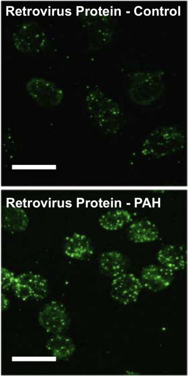 retrovirus proteins