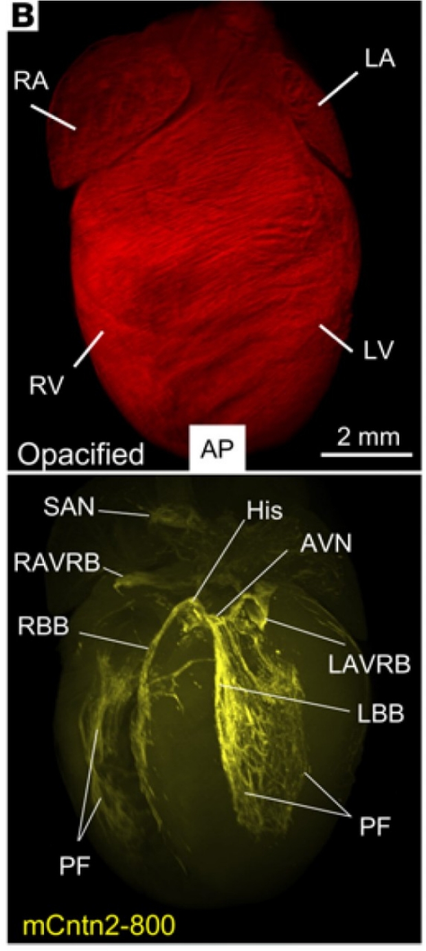 3D volumetric analyses of a mouse heart